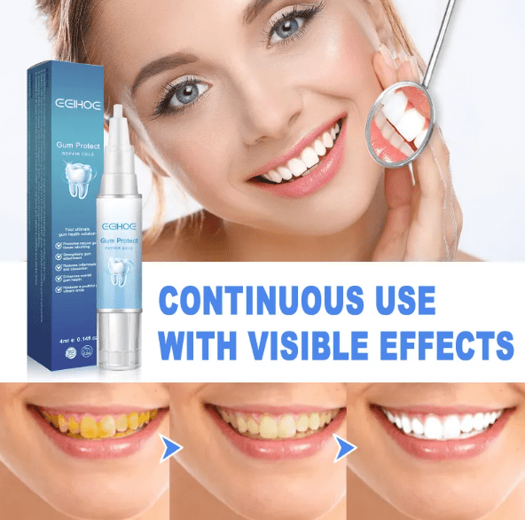Teeth Repair Gel - MegaEssentials
