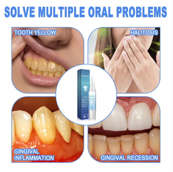 Teeth Repair Gel - MegaEssentials