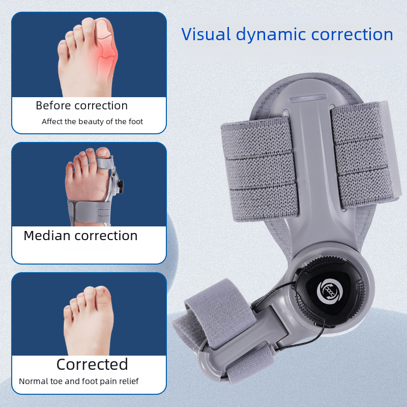 Upgraded Adjustable Bunion Corrector - MegaEssentials