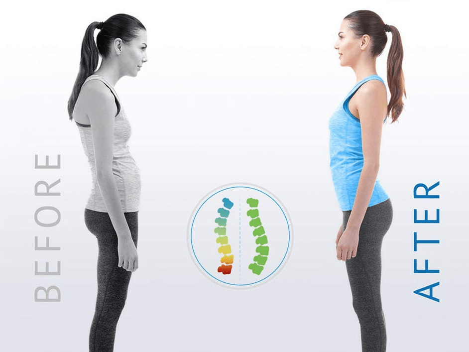 Posture Corrector - MegaEssentials