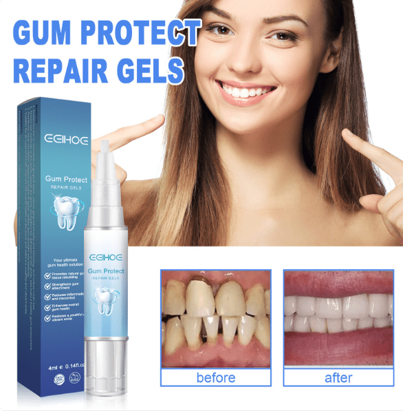 Teeth Repair Gel - MegaEssentials
